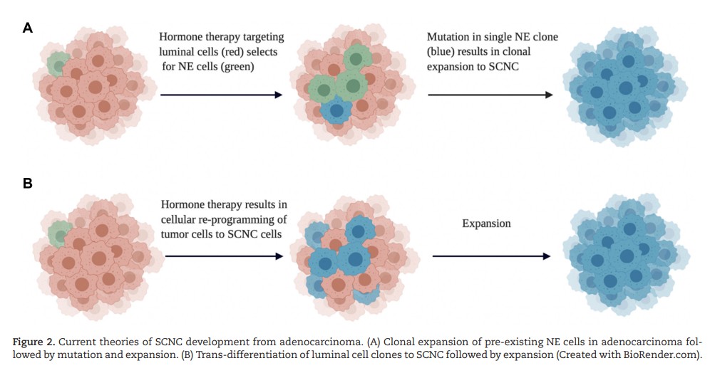 Neuroendocrine cells of the prostate